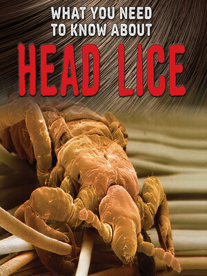 cover image of What You Need to Know about Head Lice